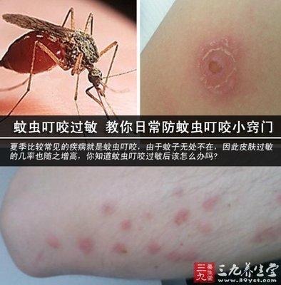 夏季防蚊虫叮咬手抄报 夏季安全手抄报