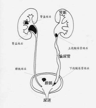 泌尿系统的简笔画