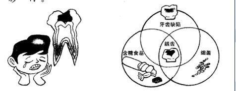 牙齿有洞怎么办 牙齿有洞应及时补牙乐乐简笔画牙齿蛀牙简笔画 第1页