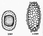 似蚓蛔线虫感染性虫卵简笔画