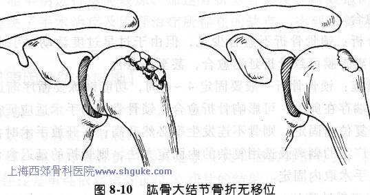 妇女结节简笔画